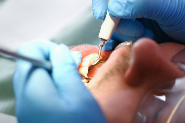 Best Broken Tooth Emergency  in Glen Ellen, CA
